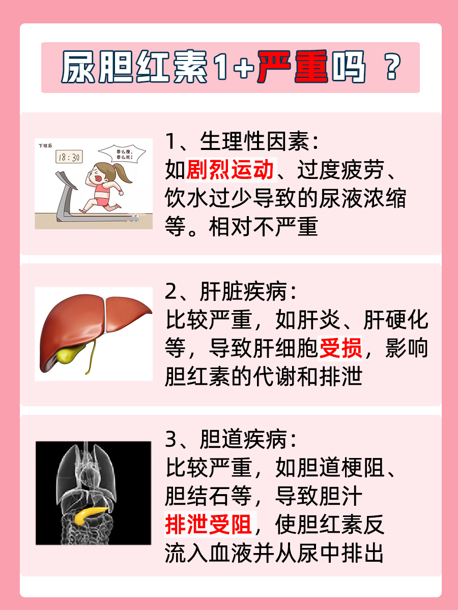 体检报告:尿胆红素1+,严重吗?一文读懂