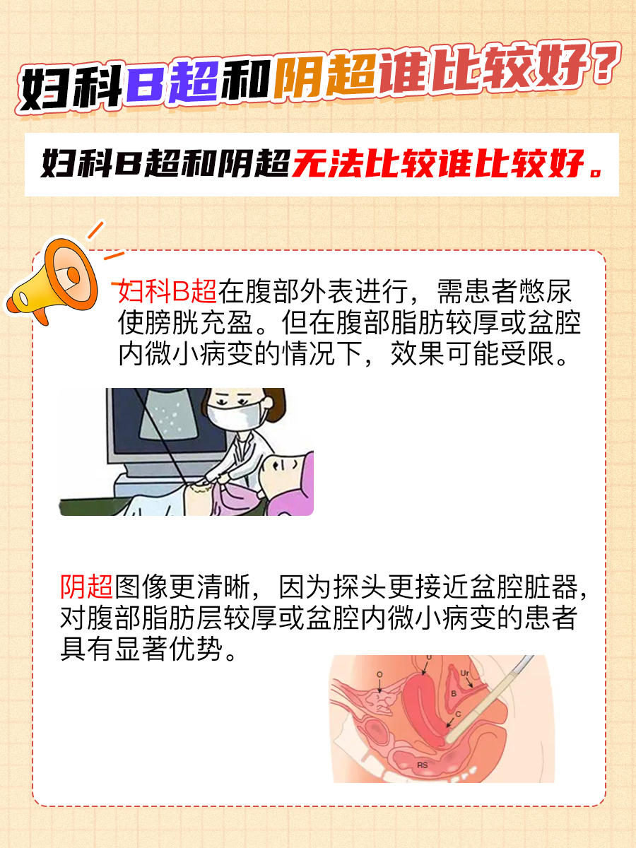 快来围观：妇科B超和阴超哪个好