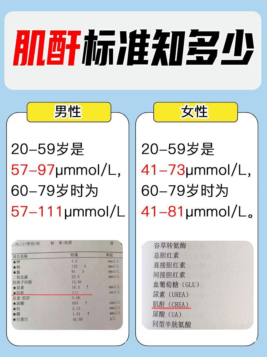 60-70岁的肌酐标准，你都知道吗？