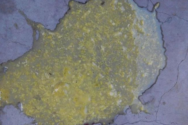 淡黄稀薄水样便图