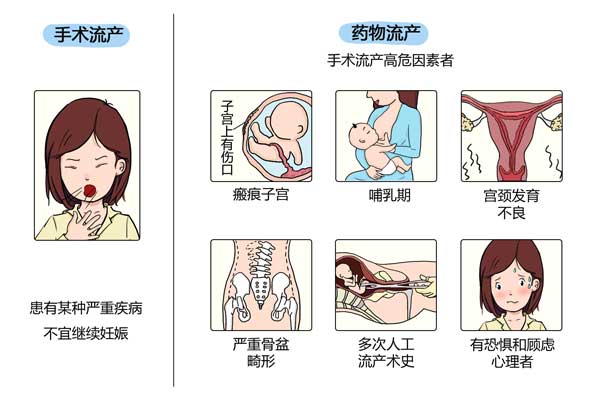 如何选择流产方法