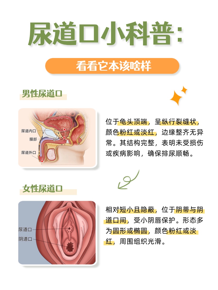 健康尿道口，原来是这样！