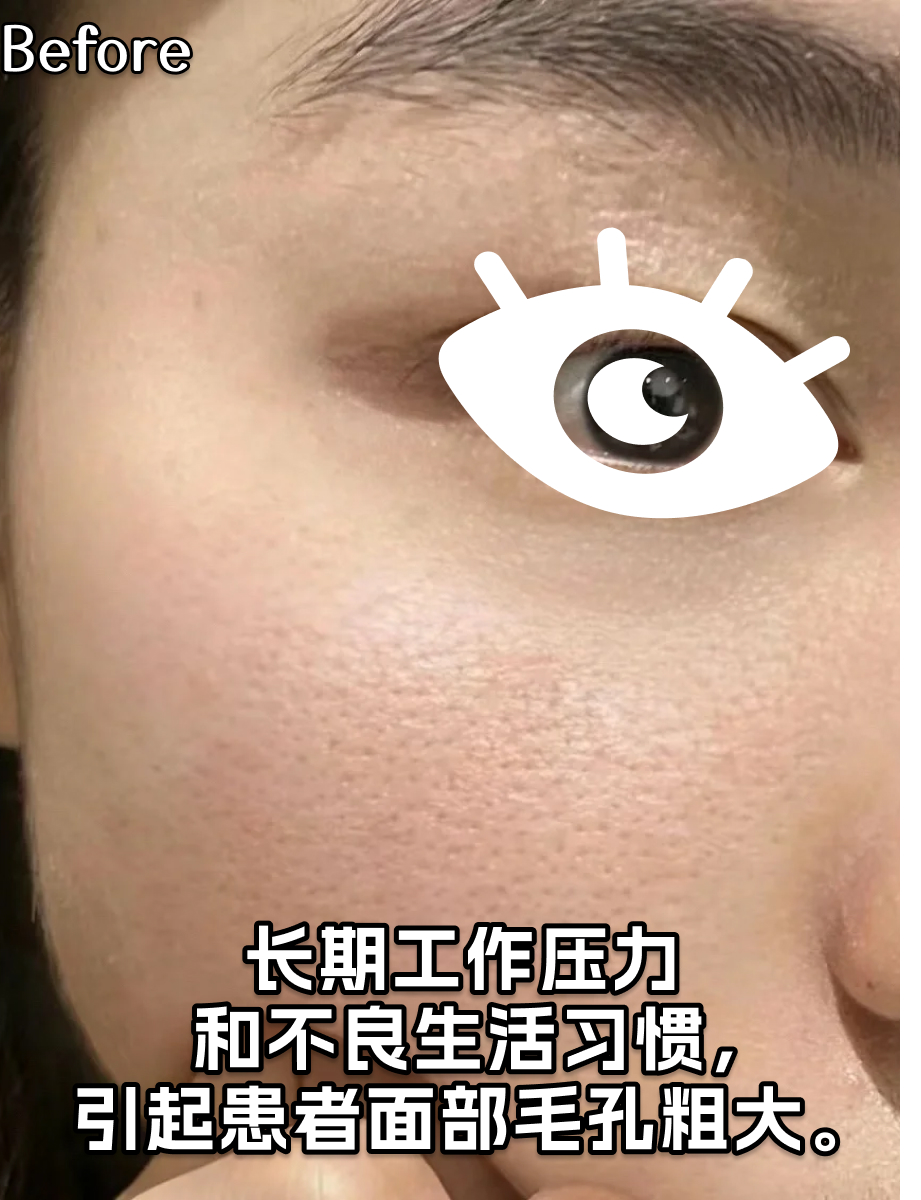 滚针也要有计划！多久做一次效果好？