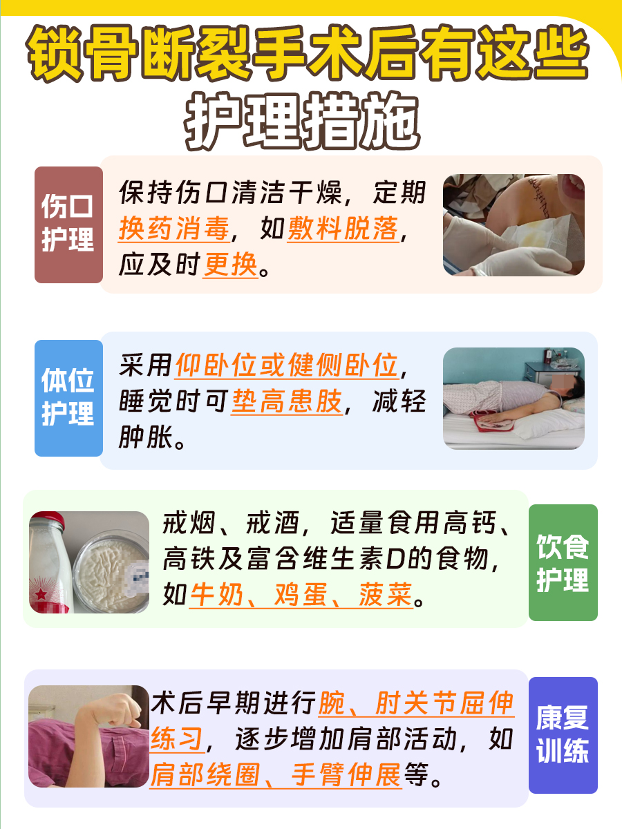 锁骨断裂手术,预算早知道