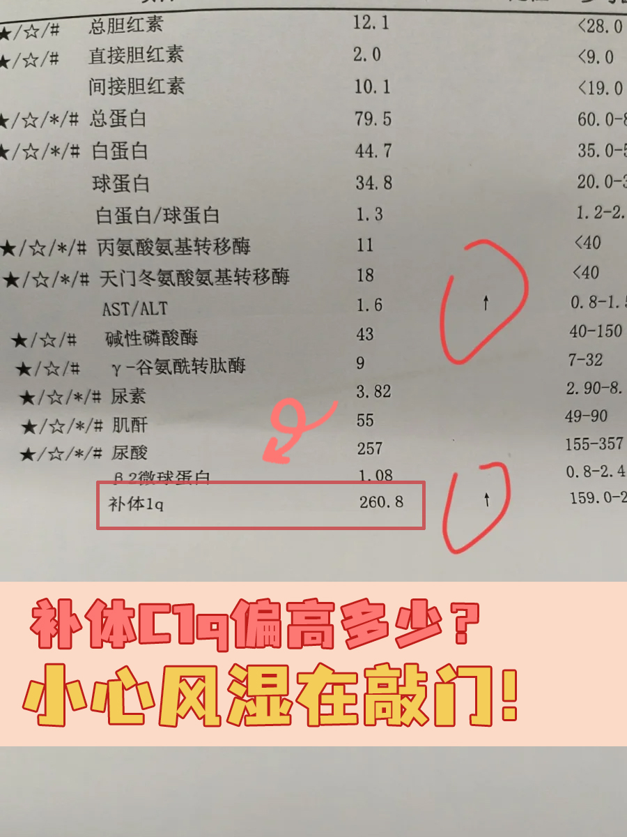 补体C1q偏高多少?小心风湿在敲门!