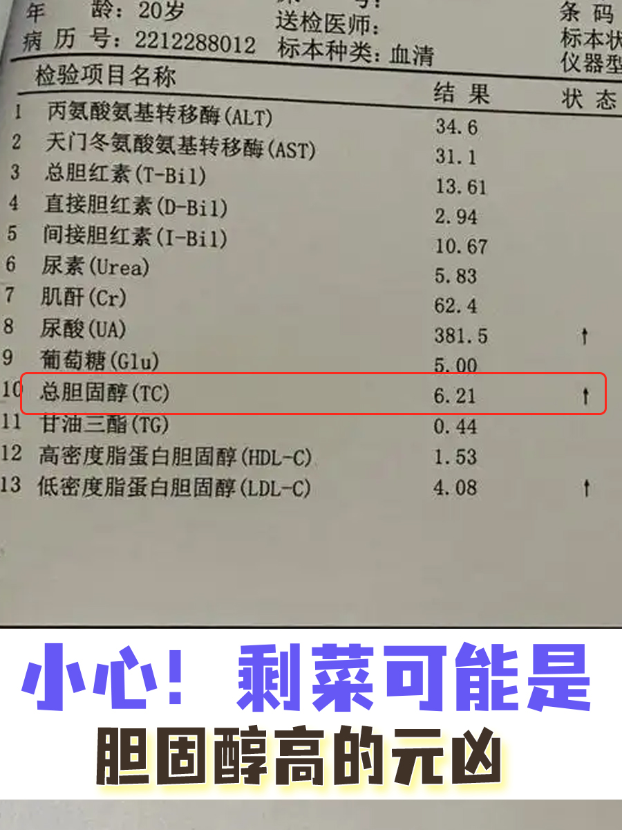 小心！剩菜可能是胆固醇高的元凶