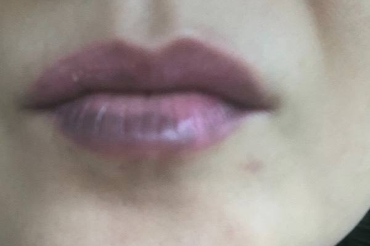 漂唇十天开始越来越黑图 漂唇十天开始越来越黑图