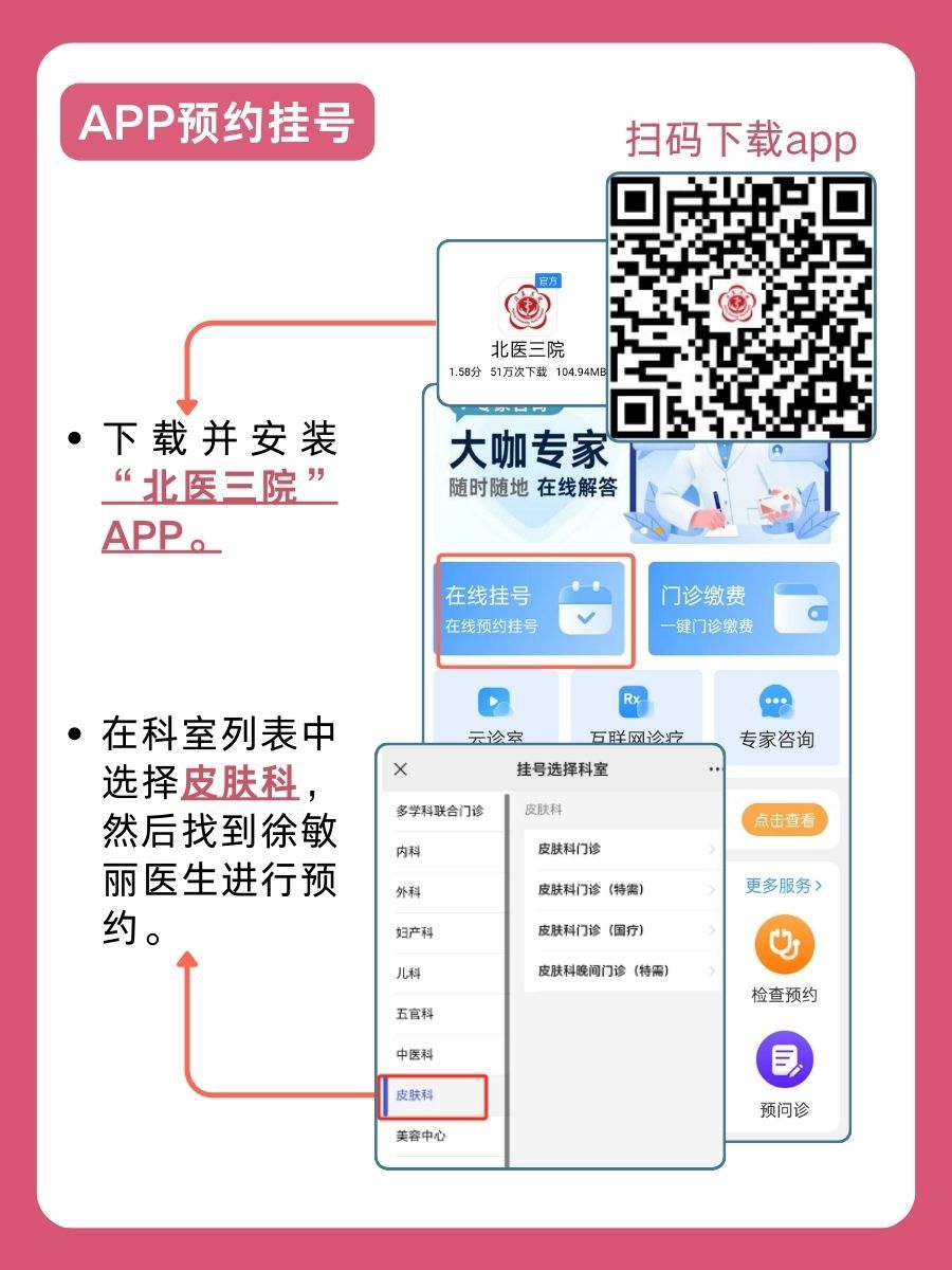 北京大学第三医院徐敏丽怎么样？怎么挂号？