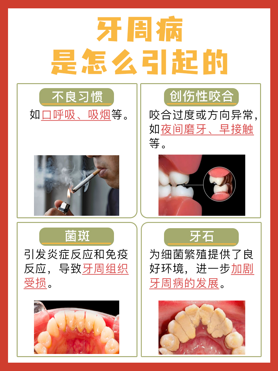 揭秘:牙周病是怎么引起的