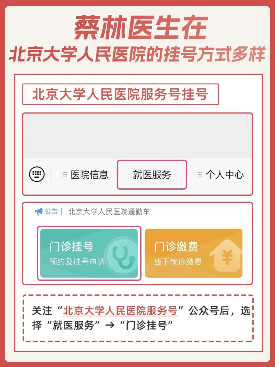 北大人民医院蔡林医生怎么样?怎么挂号?