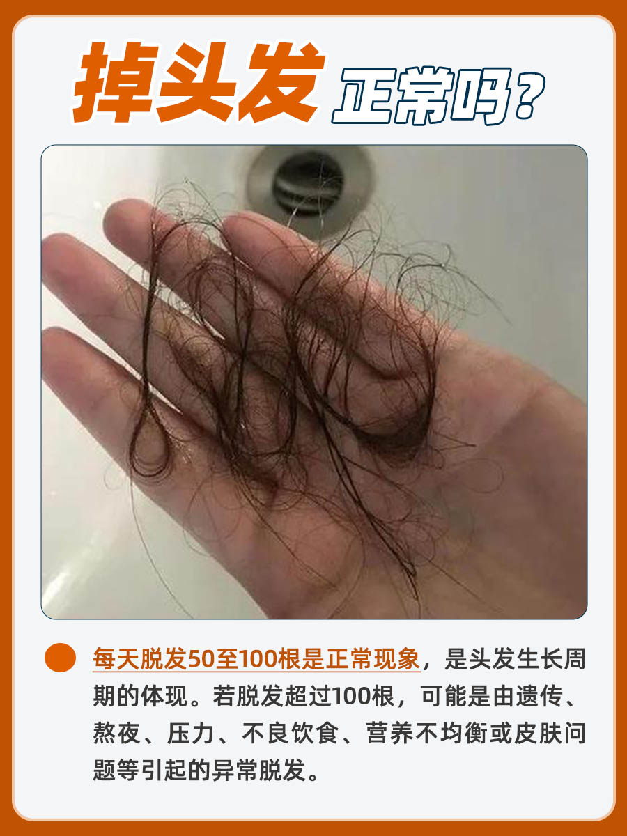 掉头发是正常现象吗？一文告诉你