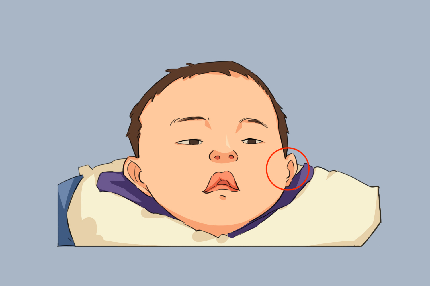 婴儿耳位低图