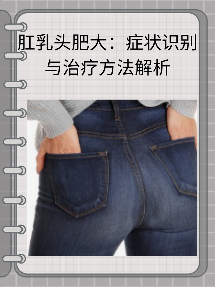 肛乳头肥大：症状识别与治疗方法解析