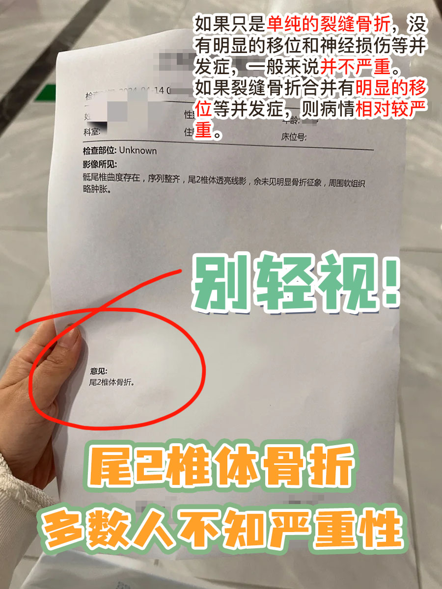 别轻视！尾2椎体骨折，多数人不知严重性
