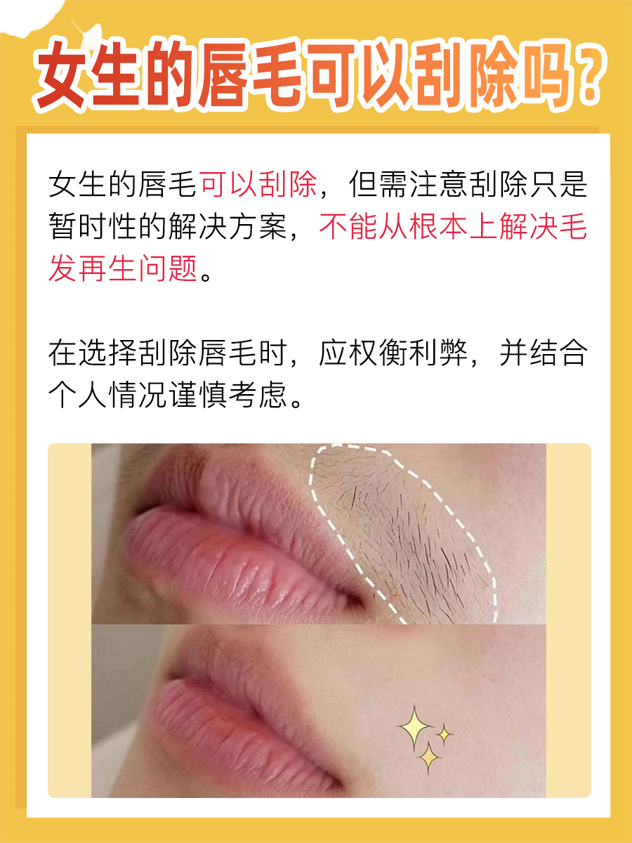 医美在线：女生唇毛可以刮吗？