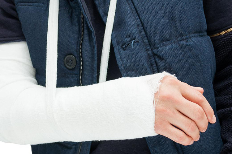 手腕石膏包扎腕部固定图