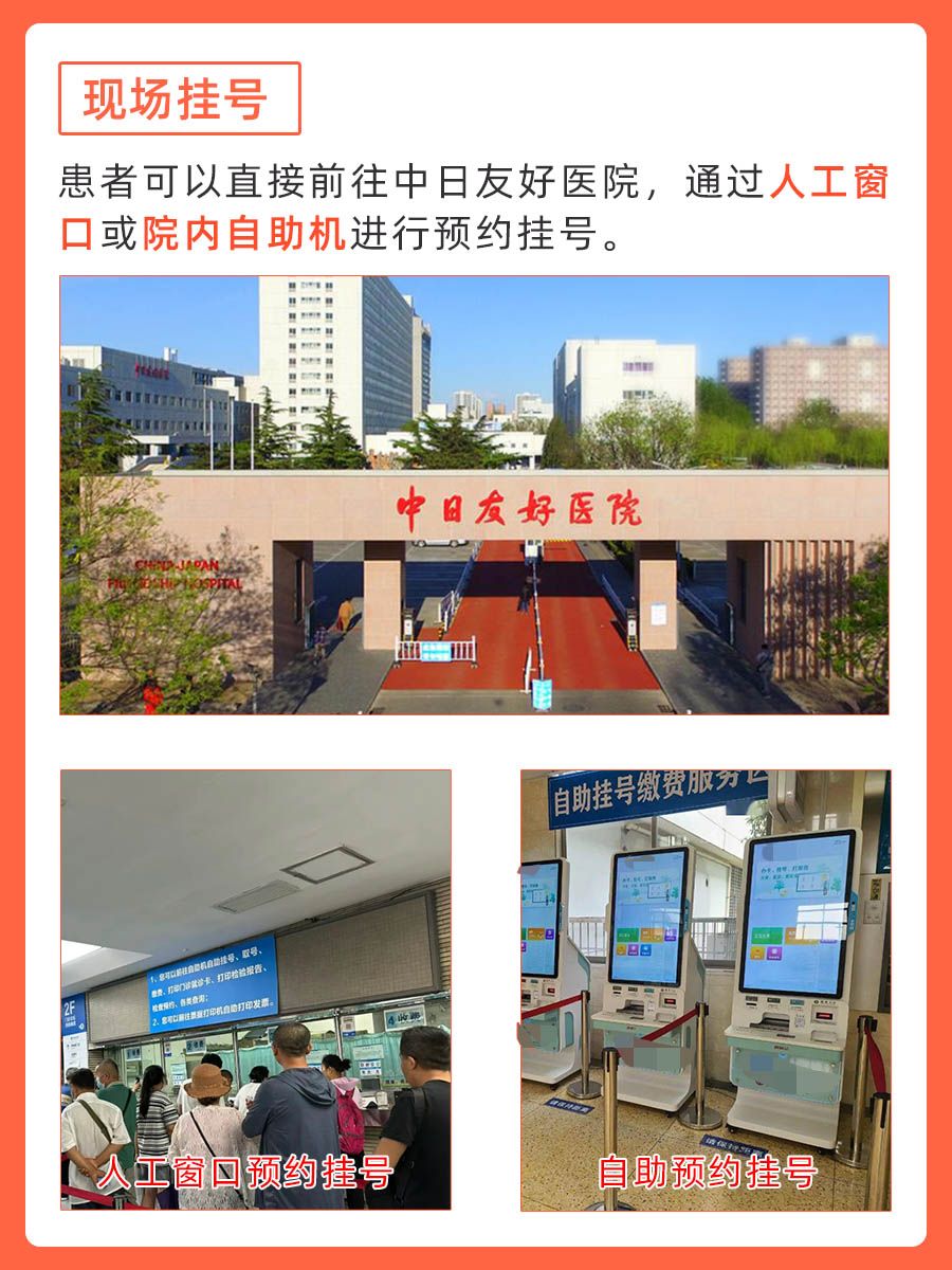 中日友好医院李海聪医生怎么样？怎么挂号？