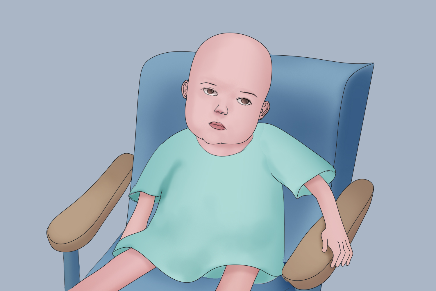 婴儿Ⅰ型脊髓性肌肉萎缩症图