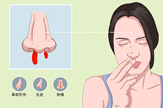 萎缩性鼻炎怎样治疗图片