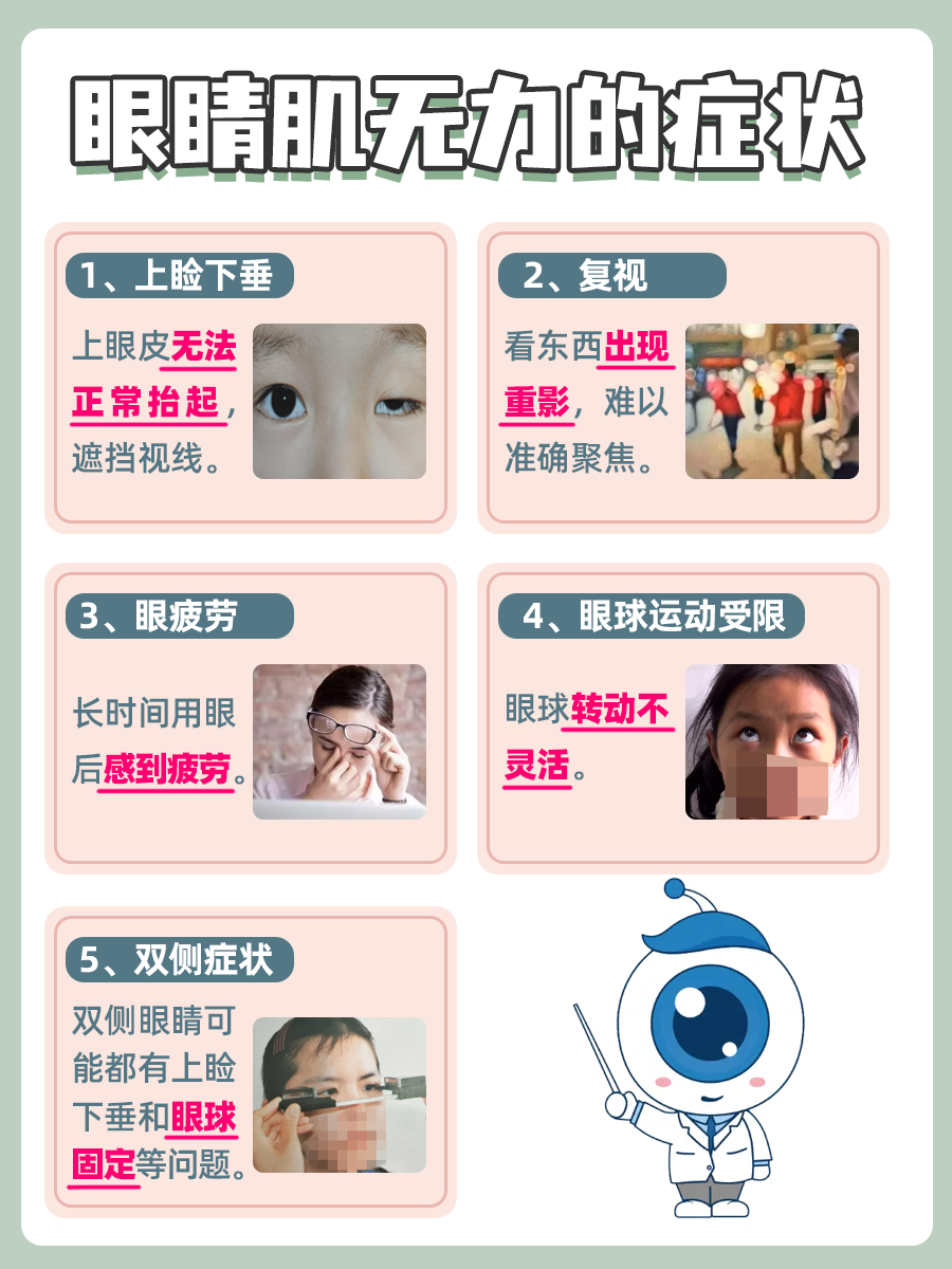 眼睛肌无力的图片