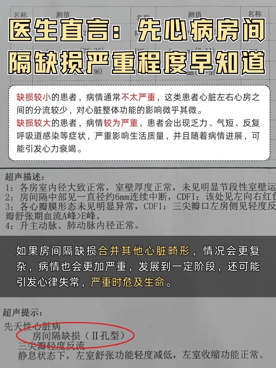 医生直言：先心病房间隔缺损严重程度早知道
