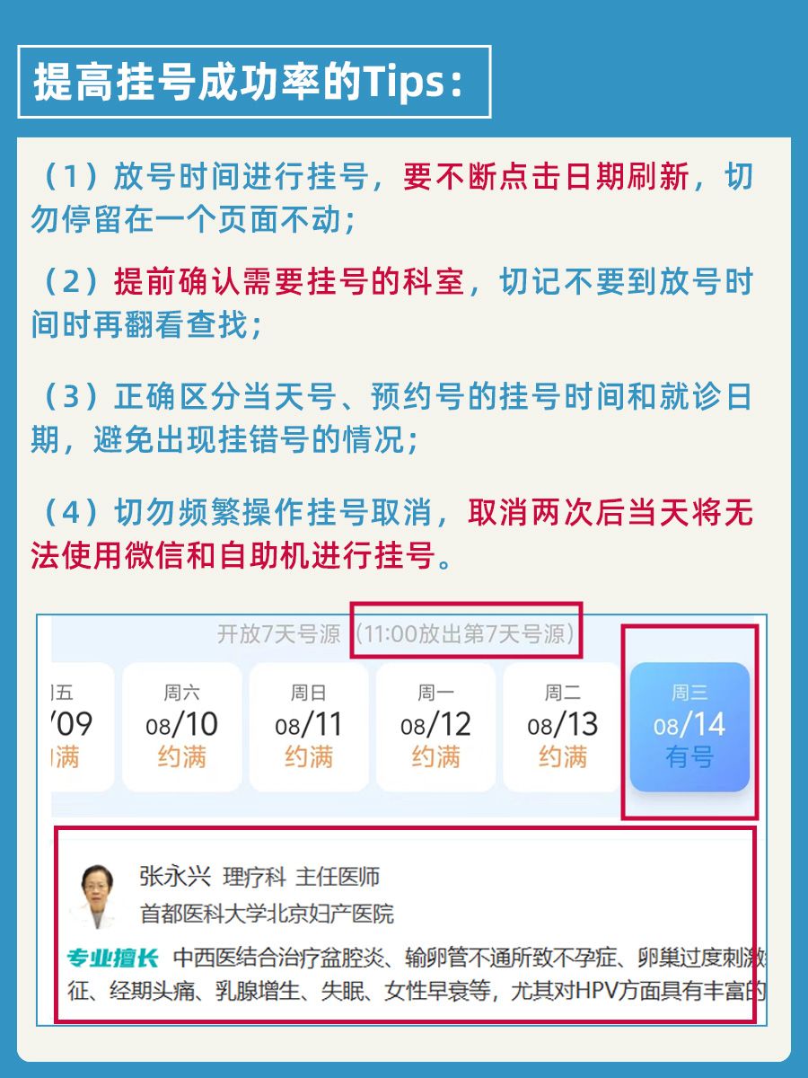 北京妇产医院张永兴医生怎么样？怎么挂号？