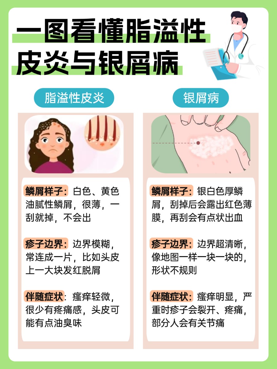 脂溢性皮炎和银屑病区分图!医生解疑