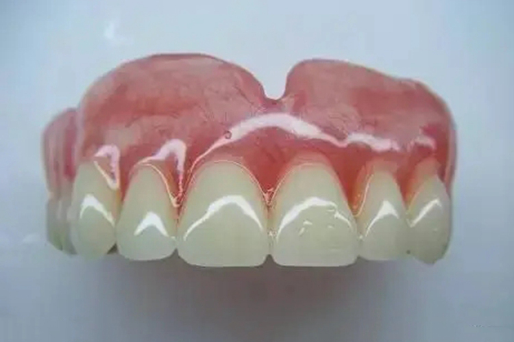 上颌半口义齿正面图