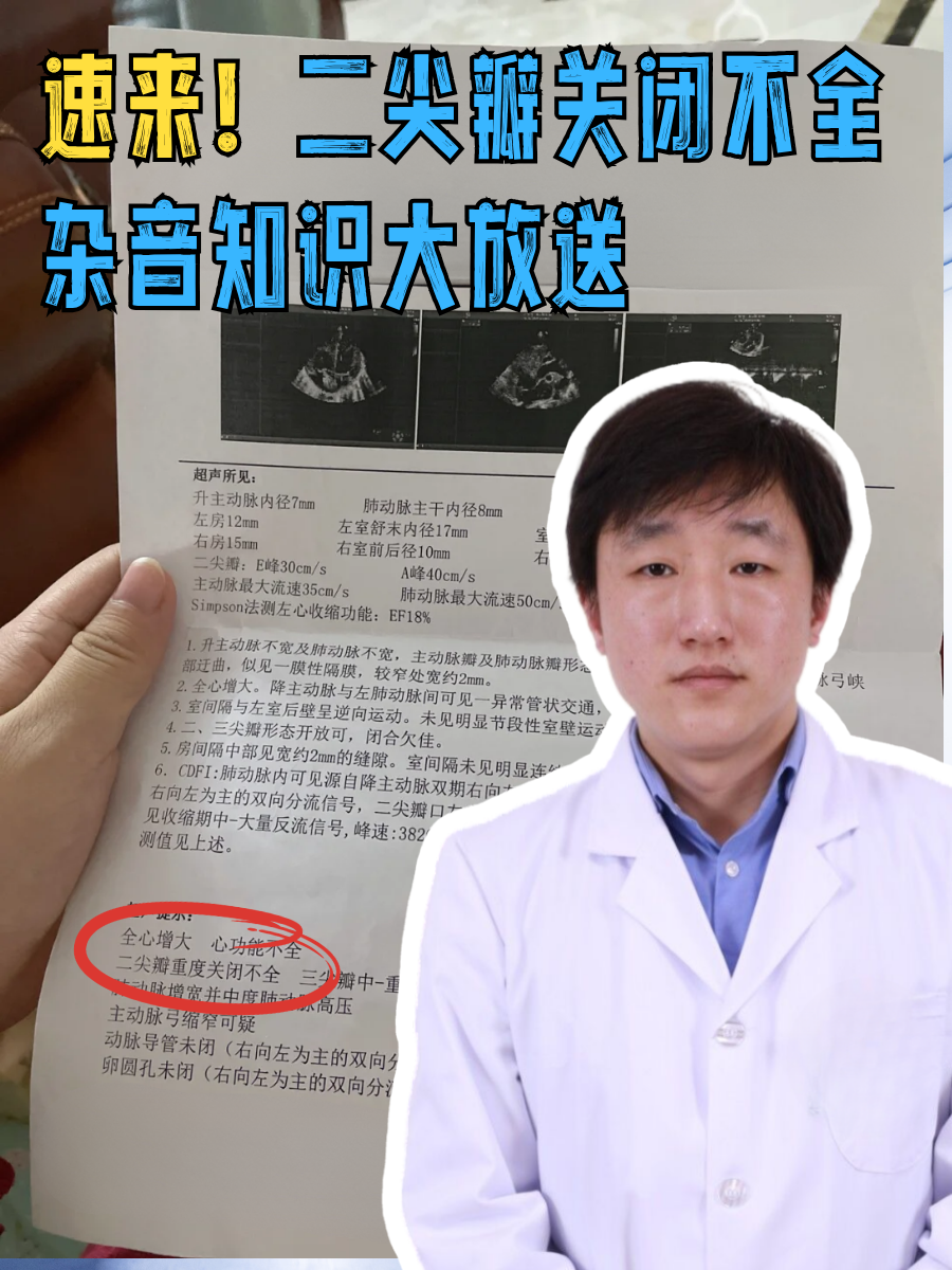 速来!二尖瓣关闭不全杂音知识大放送