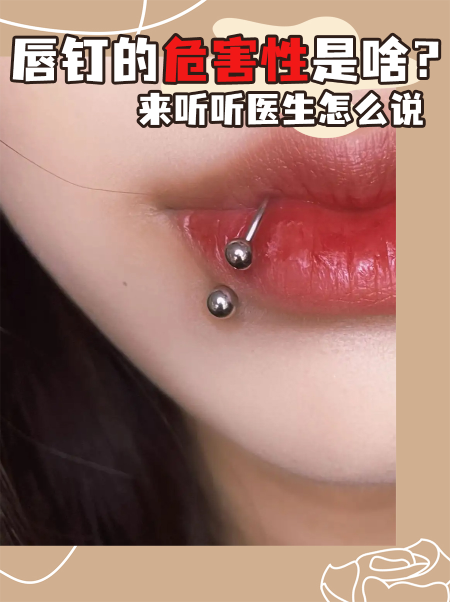 唇钉的危害性是啥？来听听医生怎么说