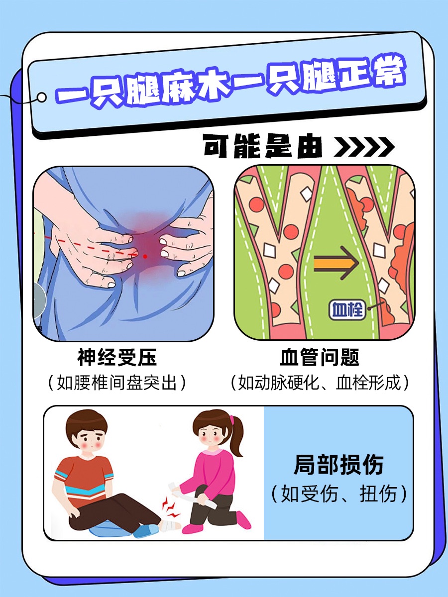 一只腿麻木一只腿正常?背后的原因可能有这些!