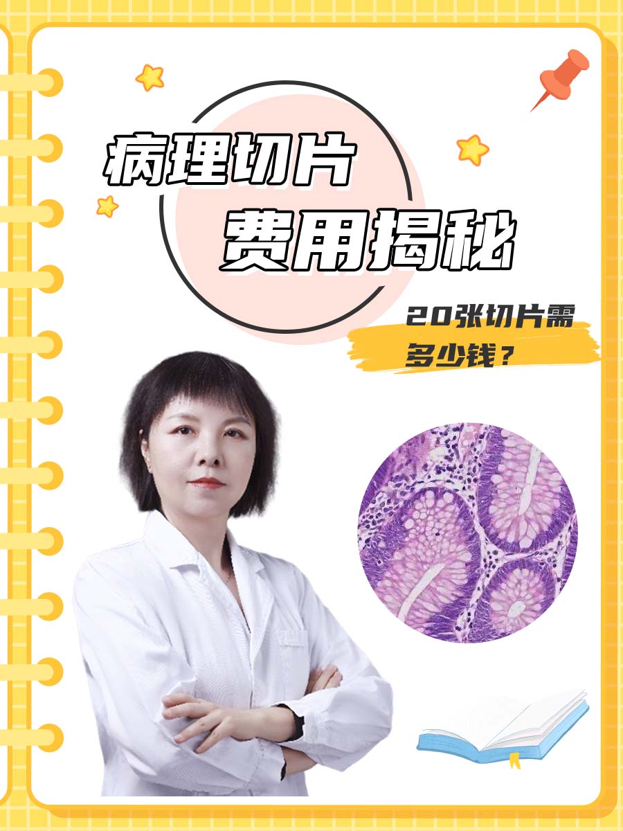 病理切片费用揭秘：20张切片需多少钱？