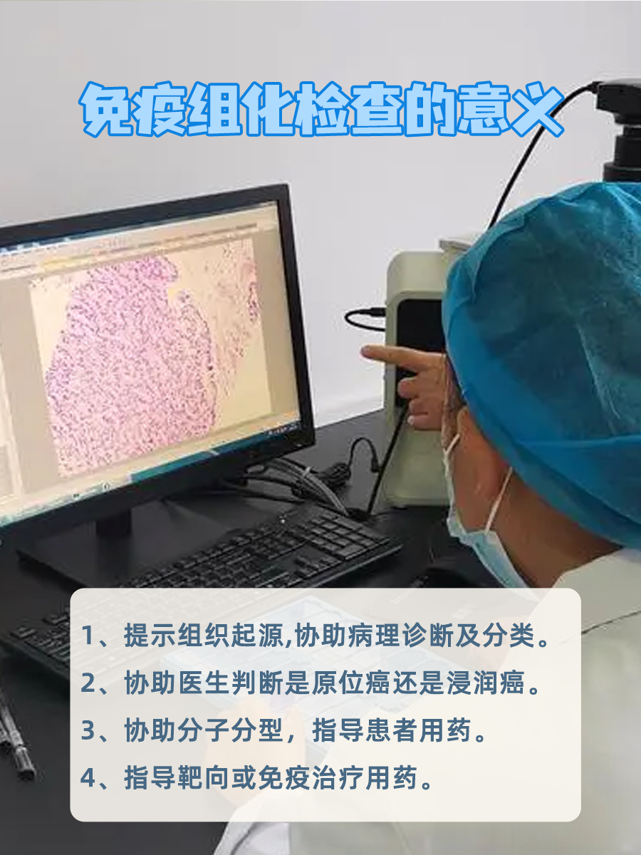什么是免疫组化检查？看完这个你就懂了
