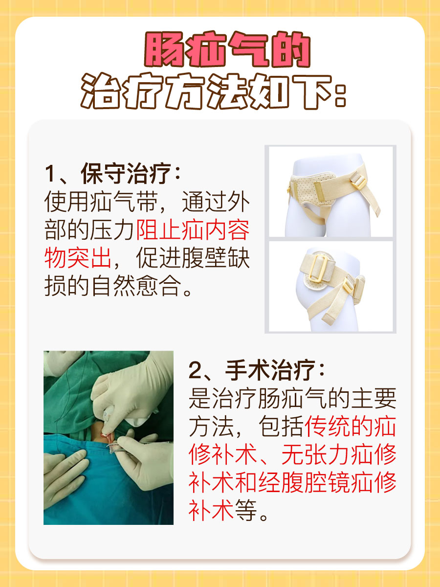 肠疝气的症状及治疗，你知道吗？