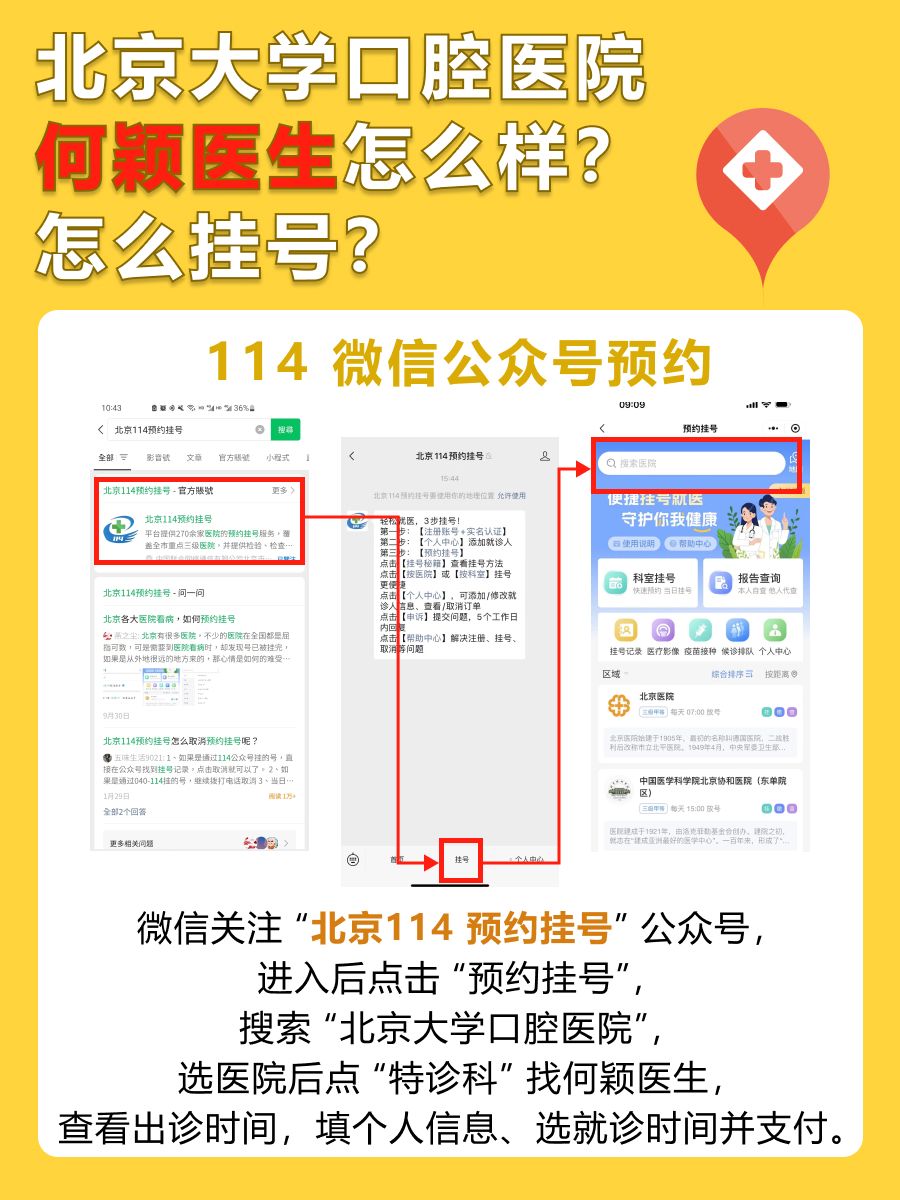北京大学口腔医院何颖医生怎么样？怎么挂号？