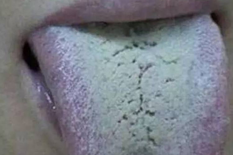 腐苔图