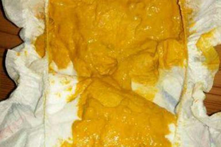 一个多月宝宝母乳喂养正常大便图