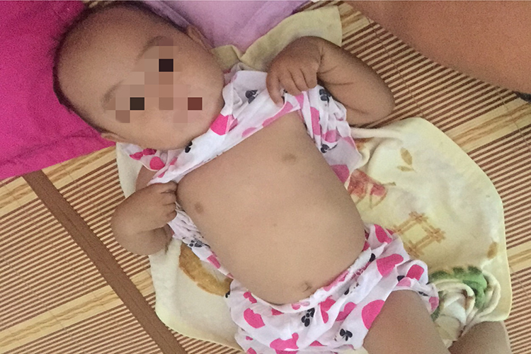 小孩正常胸部图