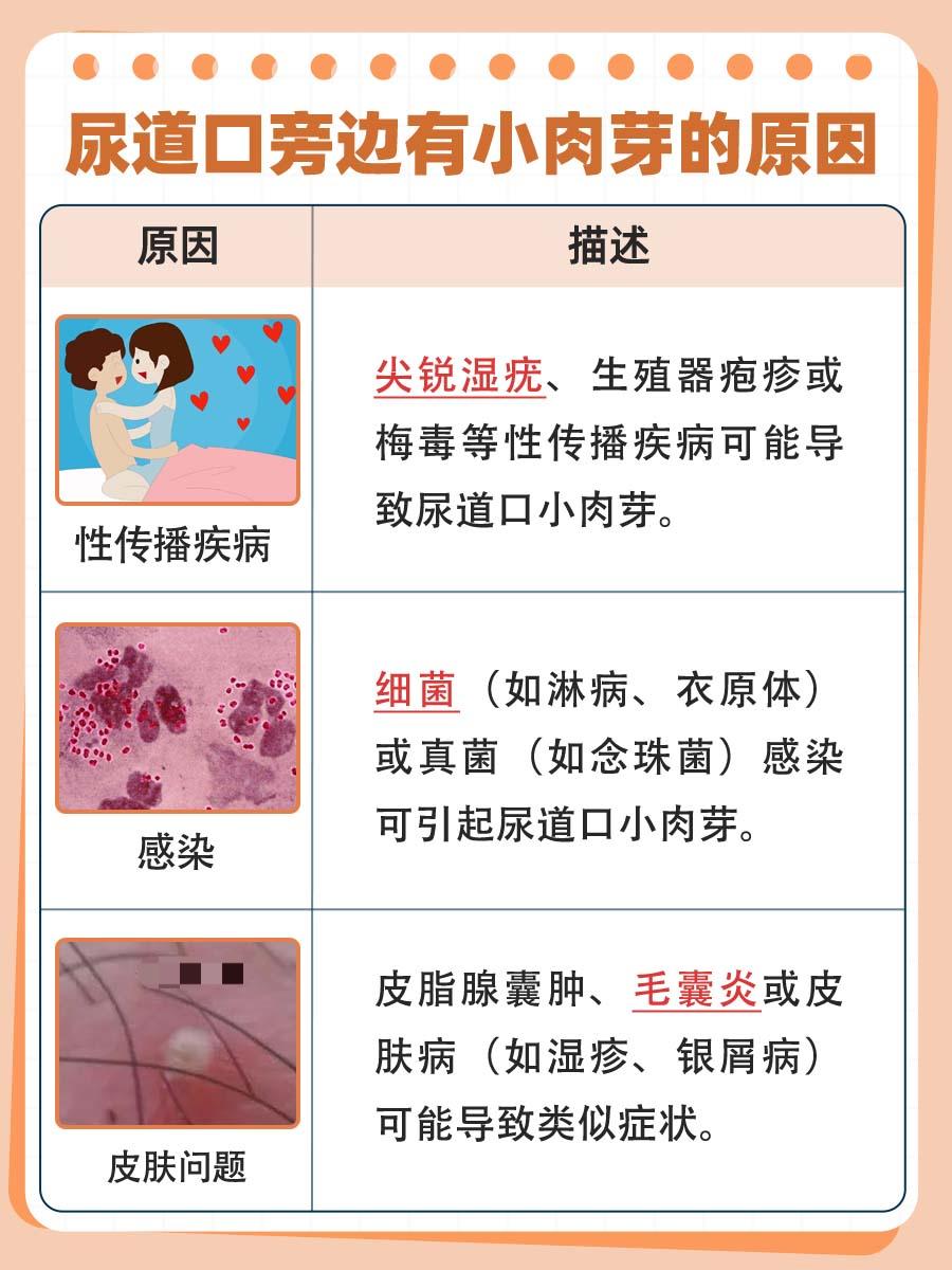 尿道口小肉芽：可能的病因有哪些