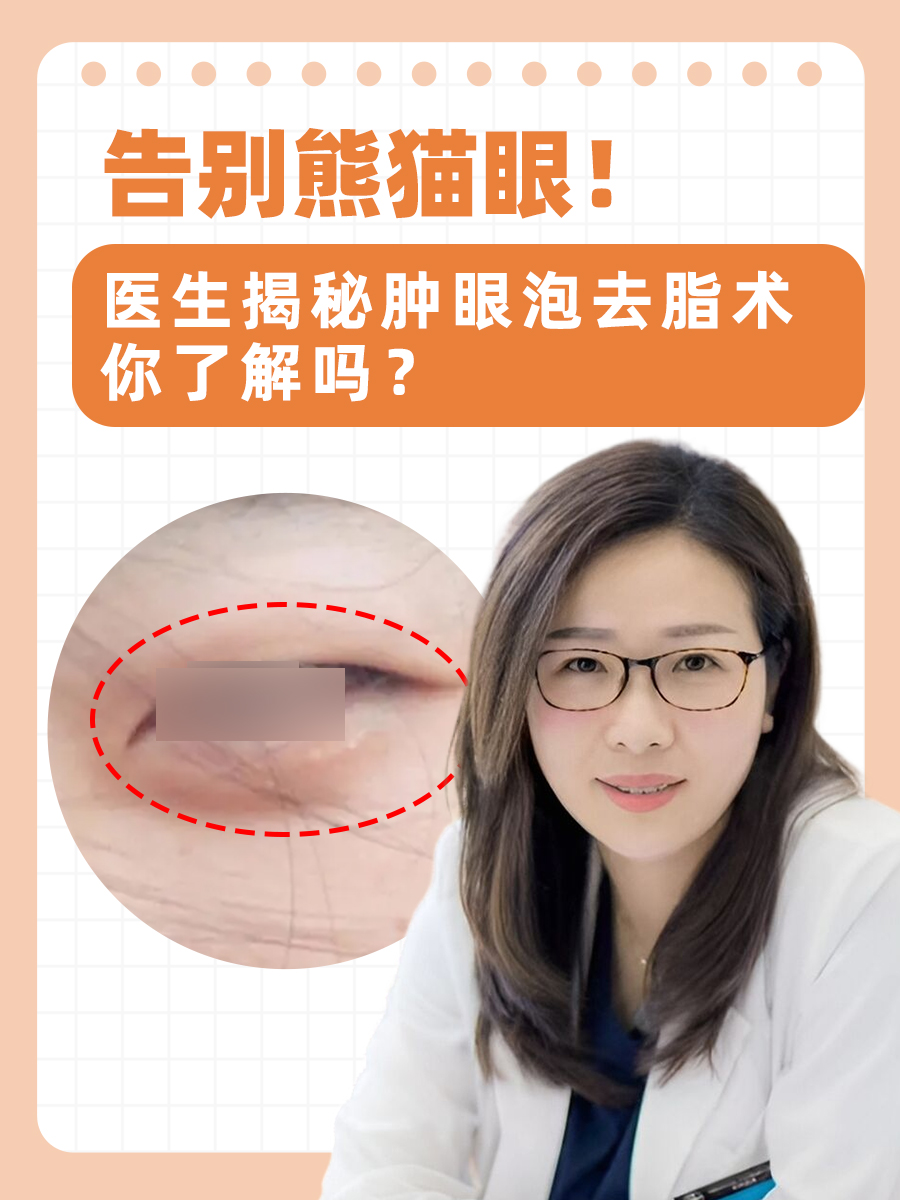 告别熊猫眼！医生揭秘肿眼泡去脂术，你了解吗？