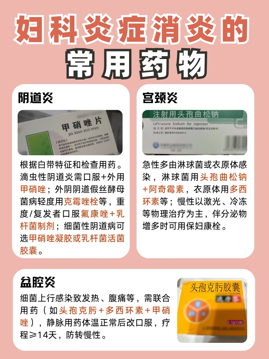 妇科炎症用什么药消炎最好？这样选择更科学