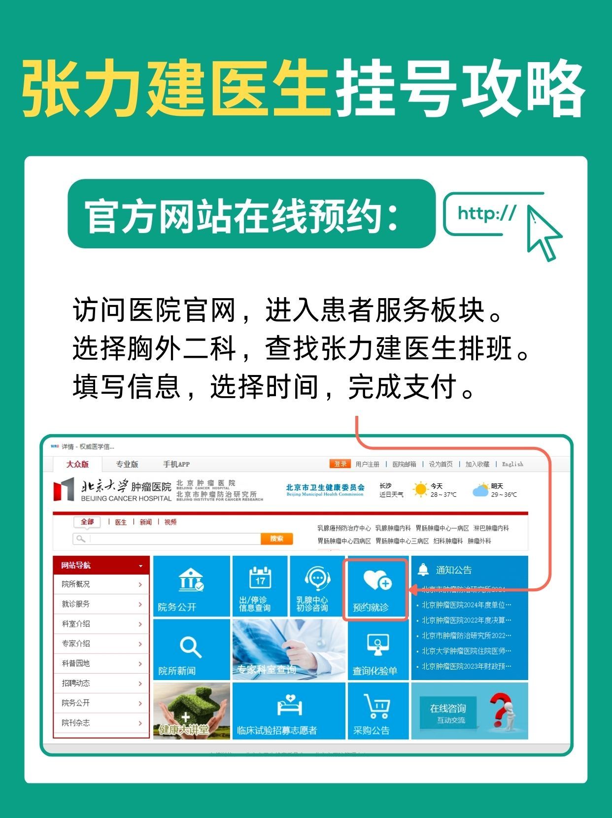 北京肿瘤医院张力建医生怎么样？怎么挂号？