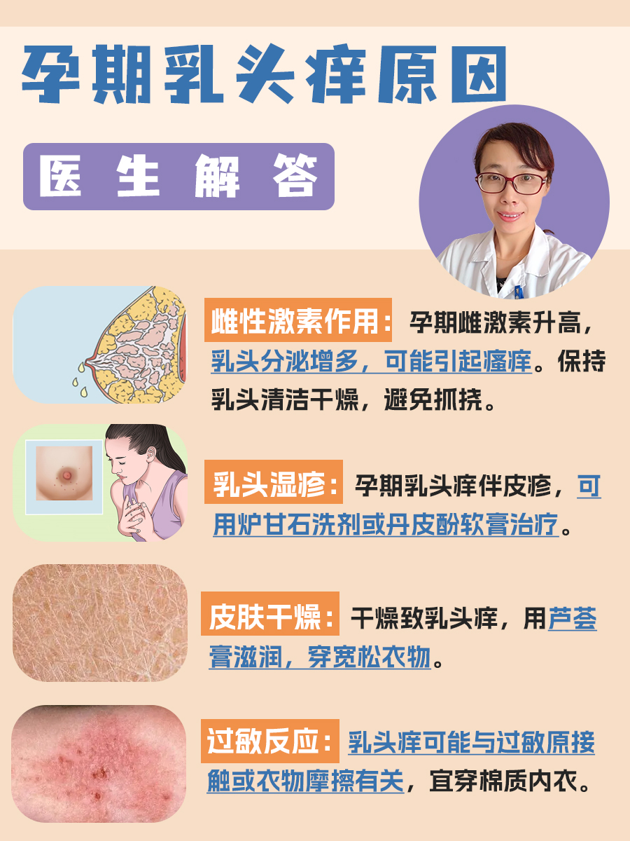 孕期乳头痒的原因：医生解答