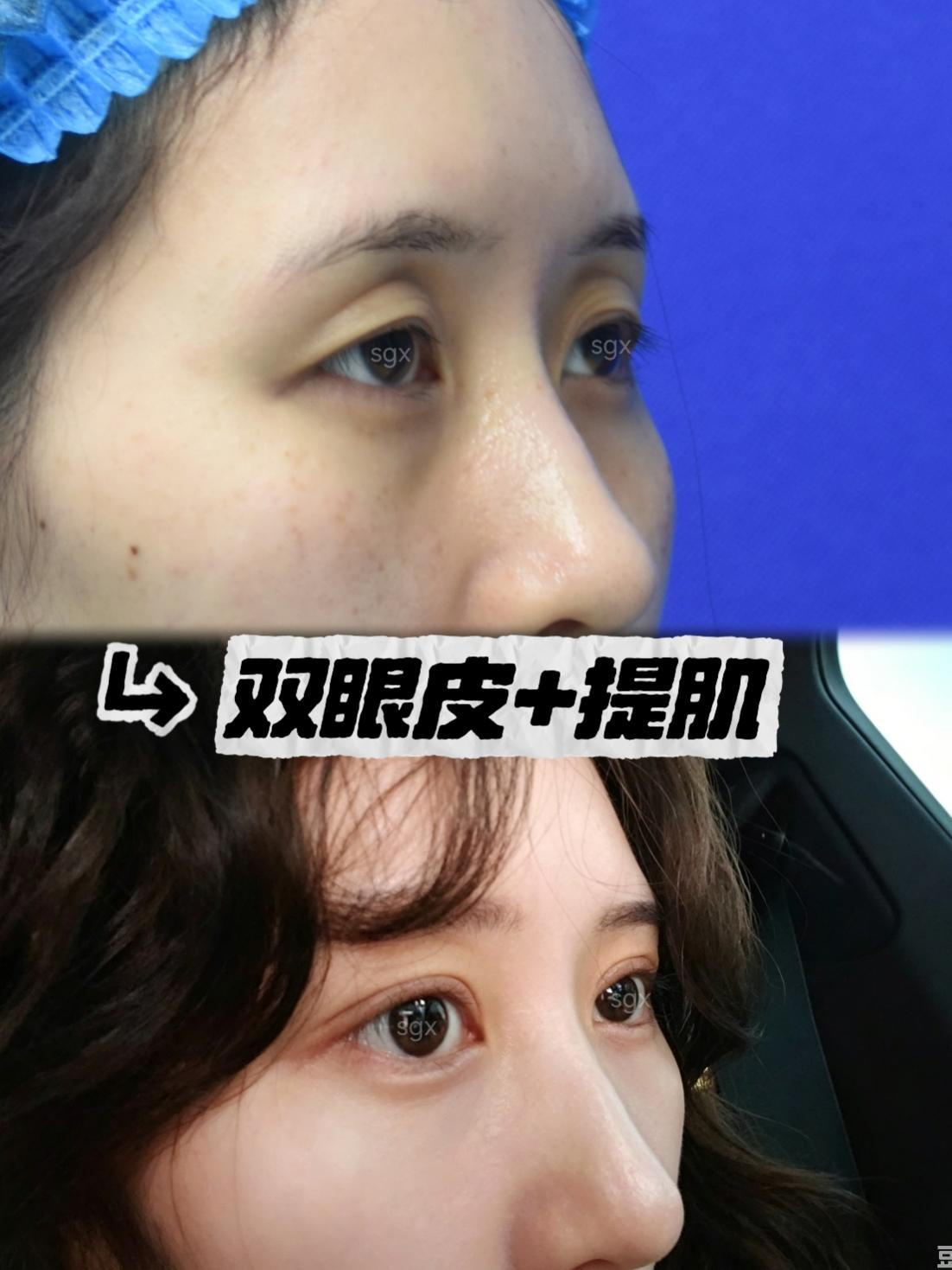 图片39.png
