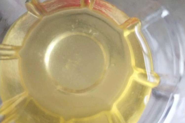 膀胱炎尿液里有白色皮屑图