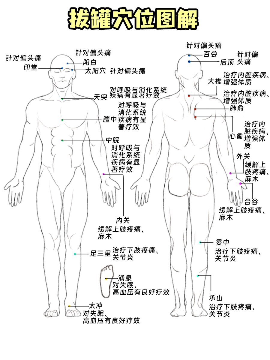 专业中医讲解：拔罐穴位图