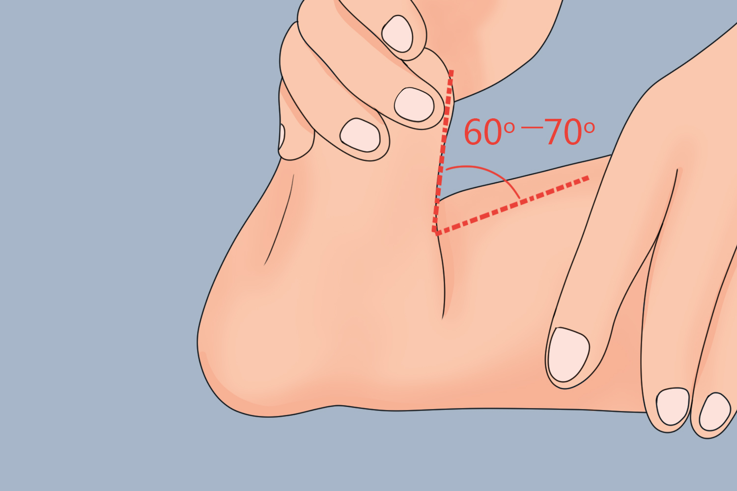 足背屈角正常图