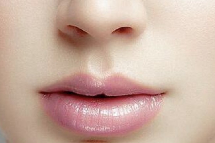 鼻唇沟不明显图