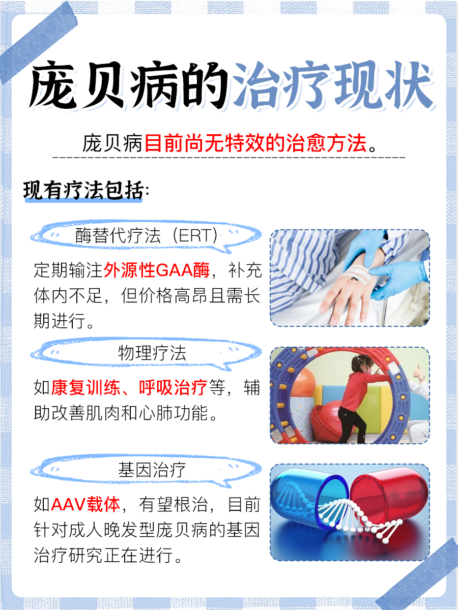 庞贝病：治疗现状与希望