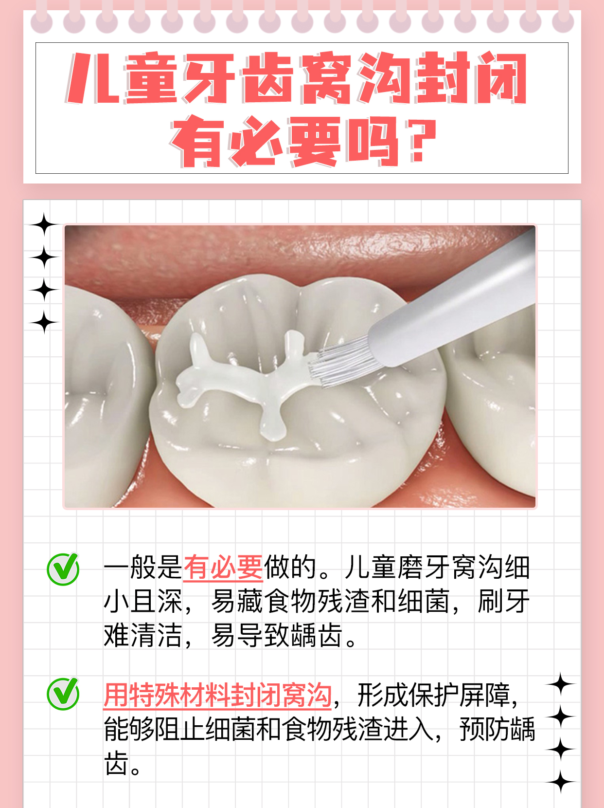 爱牙从娃娃抓起，窝沟封闭有必要